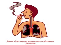 Туберкулез